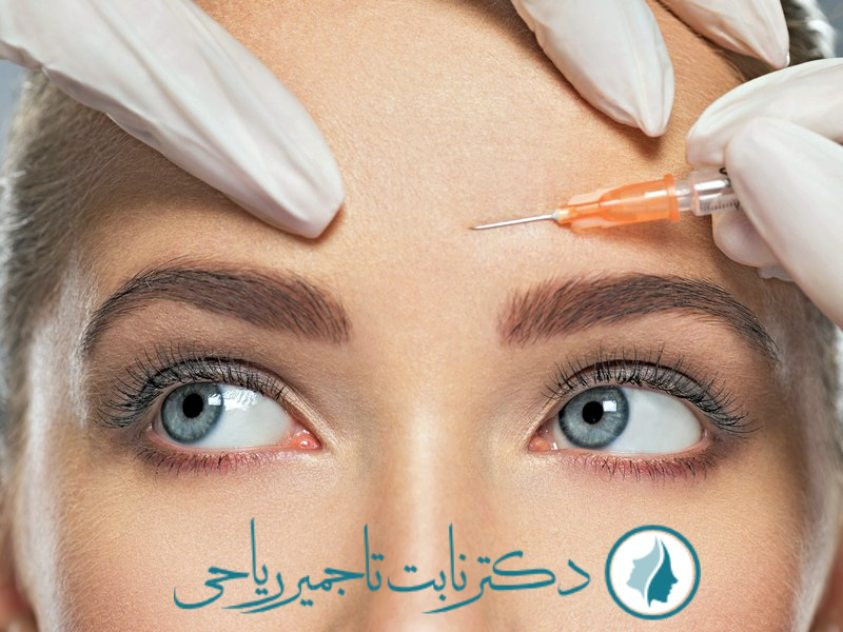تزریق بوتاکس botox